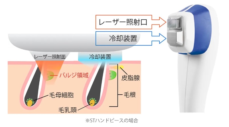 冷却装置搭載で肌へのダメージを抑制