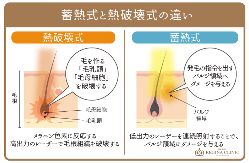 レジーナクリニック引用「バルジ領域」