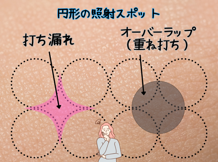 円形スポット